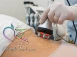 لاغری موضعی با دستگاه RF